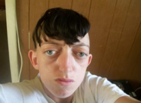 bugeyes, balding, no chin, awful ratios, subhuman.png